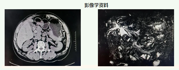 QQ截图20250526085823.png