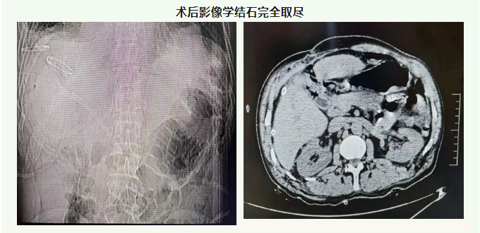 QQ截图20250526085912.png
