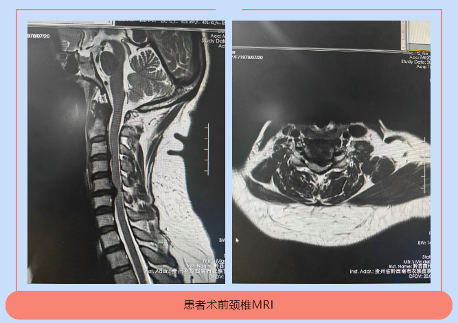 QQ截图20250618111635.png