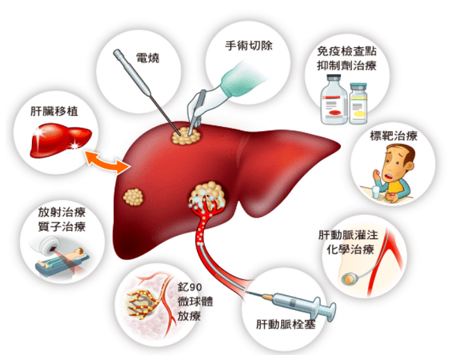 【州医科普】张广蕾：预防肝癌，从现在做起