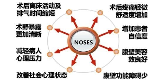 胃肠腹壁疝外科成功实施腹壁无辅助切口的腹腔镜直肠癌根治术